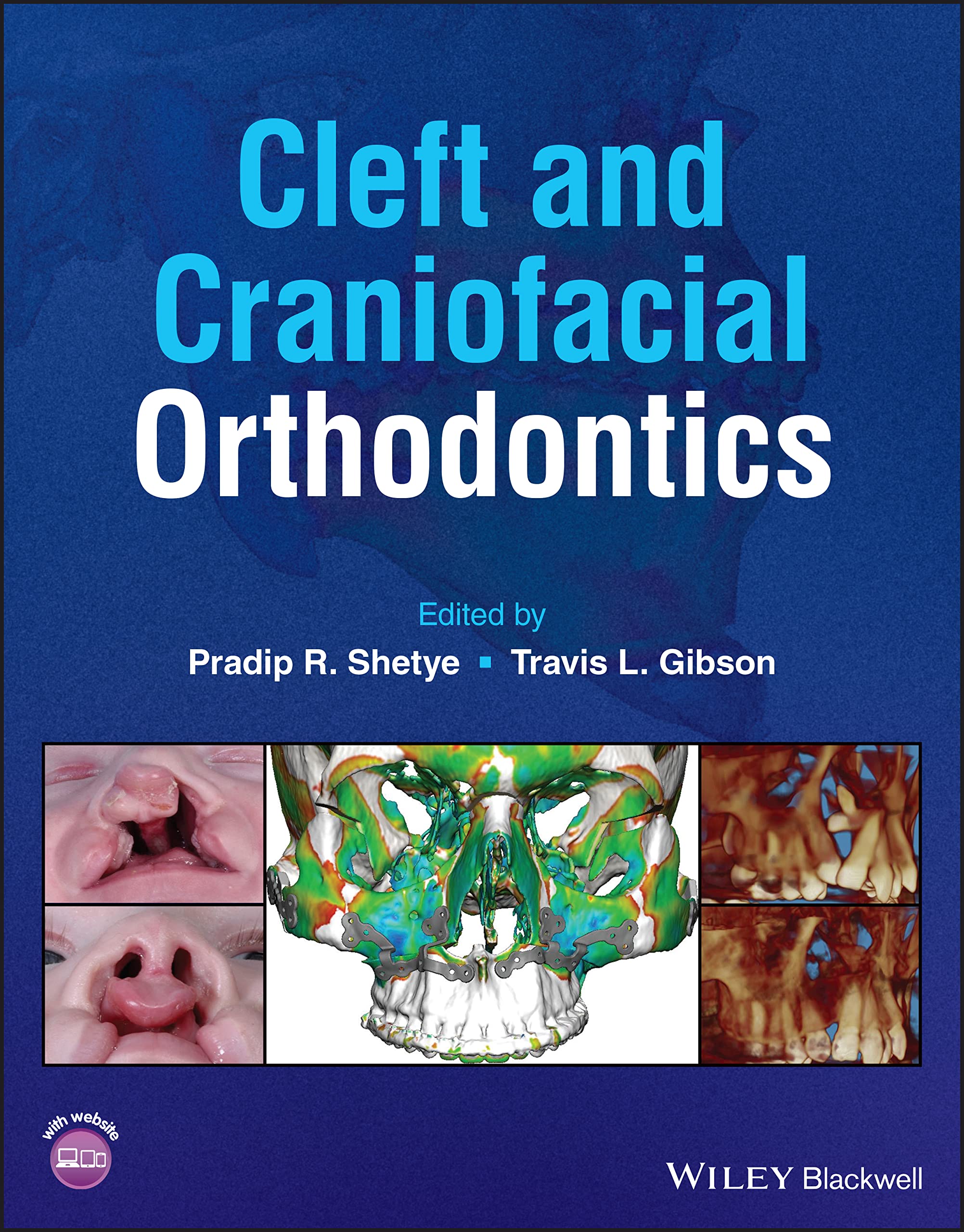 Cover of Cleft and Craniofacial Orthodontics