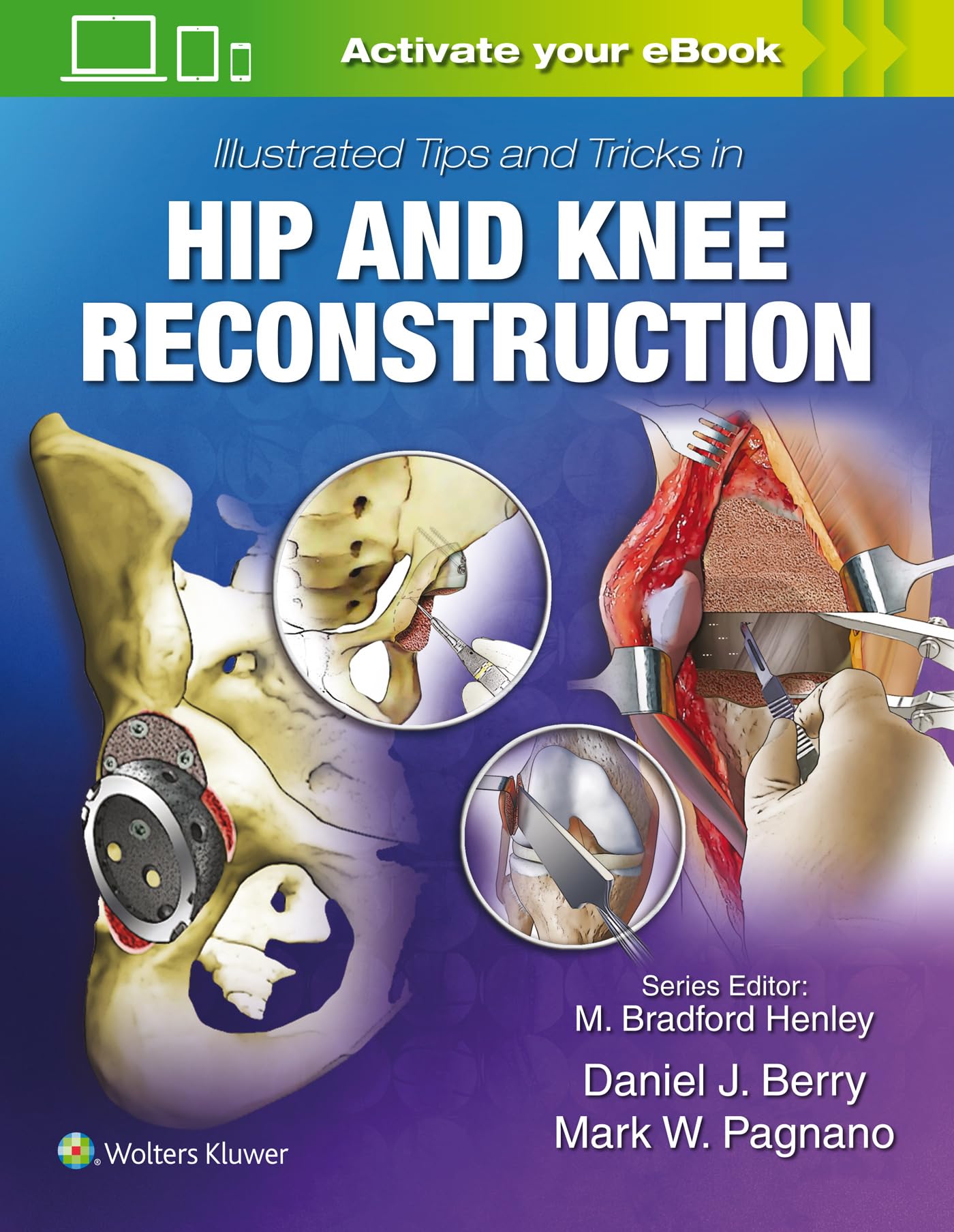 Cover of Illustrated Tips and Tricks in Hip and Knee Reconstructive and Replacement Surgery
