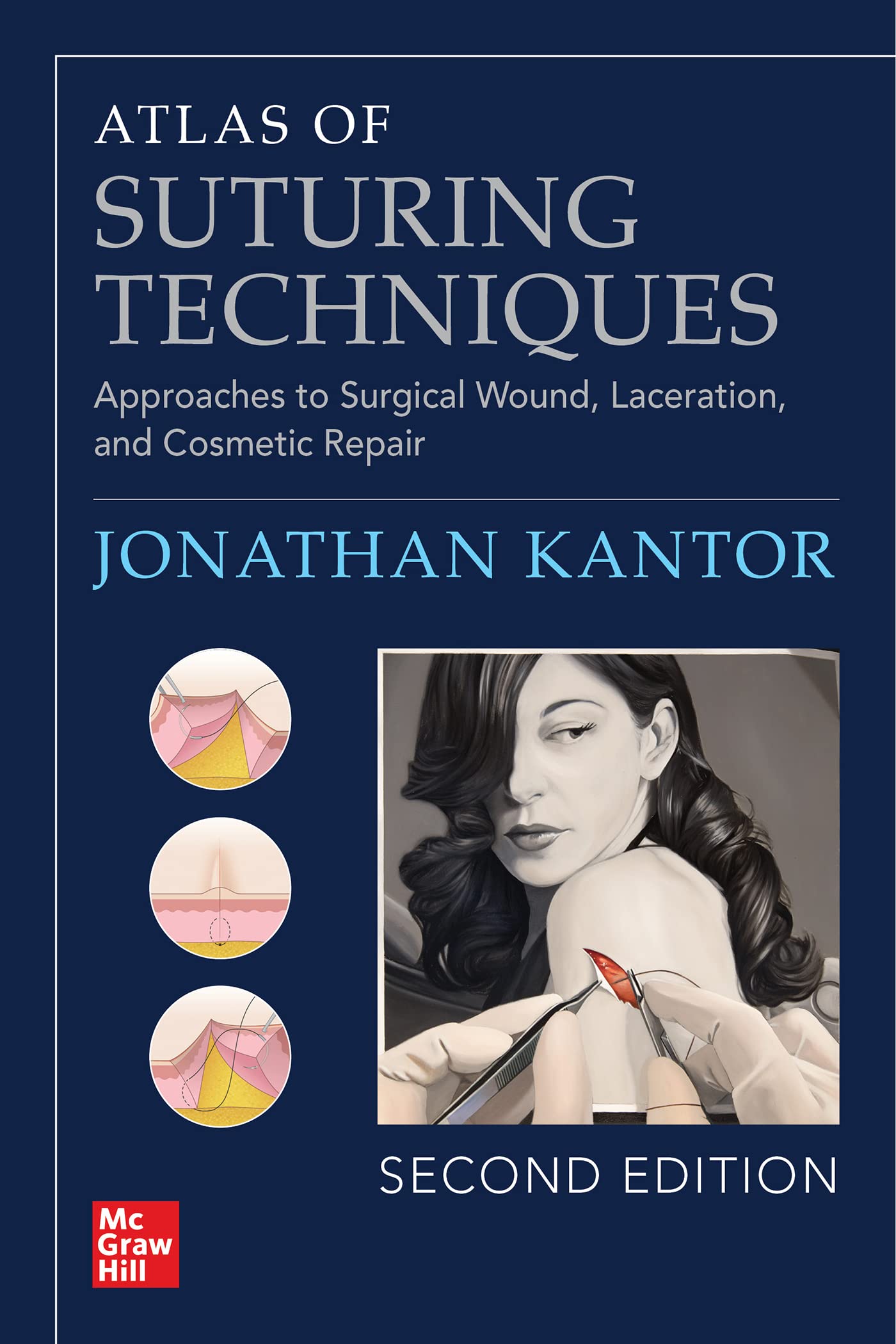 Cover of Atlas of Suturing Techniques: Approaches to Surgical Wound, Laceration, and Cosmetic Repair, Second Edition