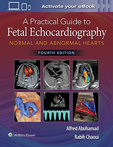 Cover of A Practical Guide to Fetal Echocardiography: Normal and Abnormal Hearts