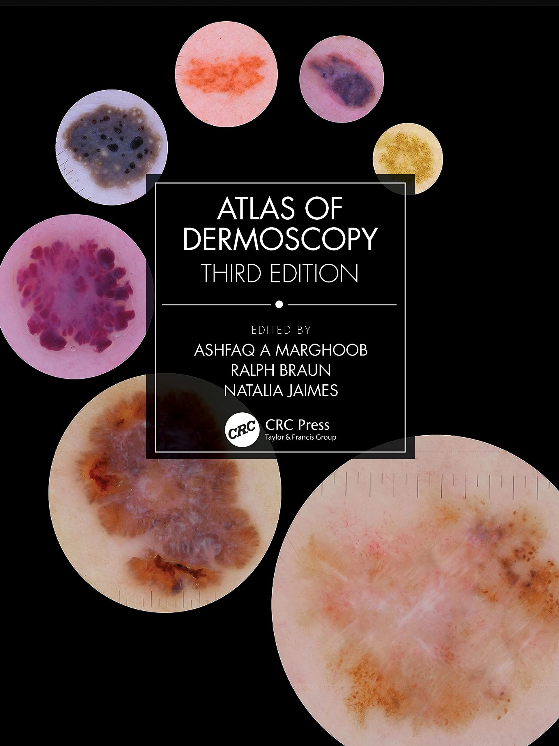 Cover of Atlas of Dermoscopy: Third Edition