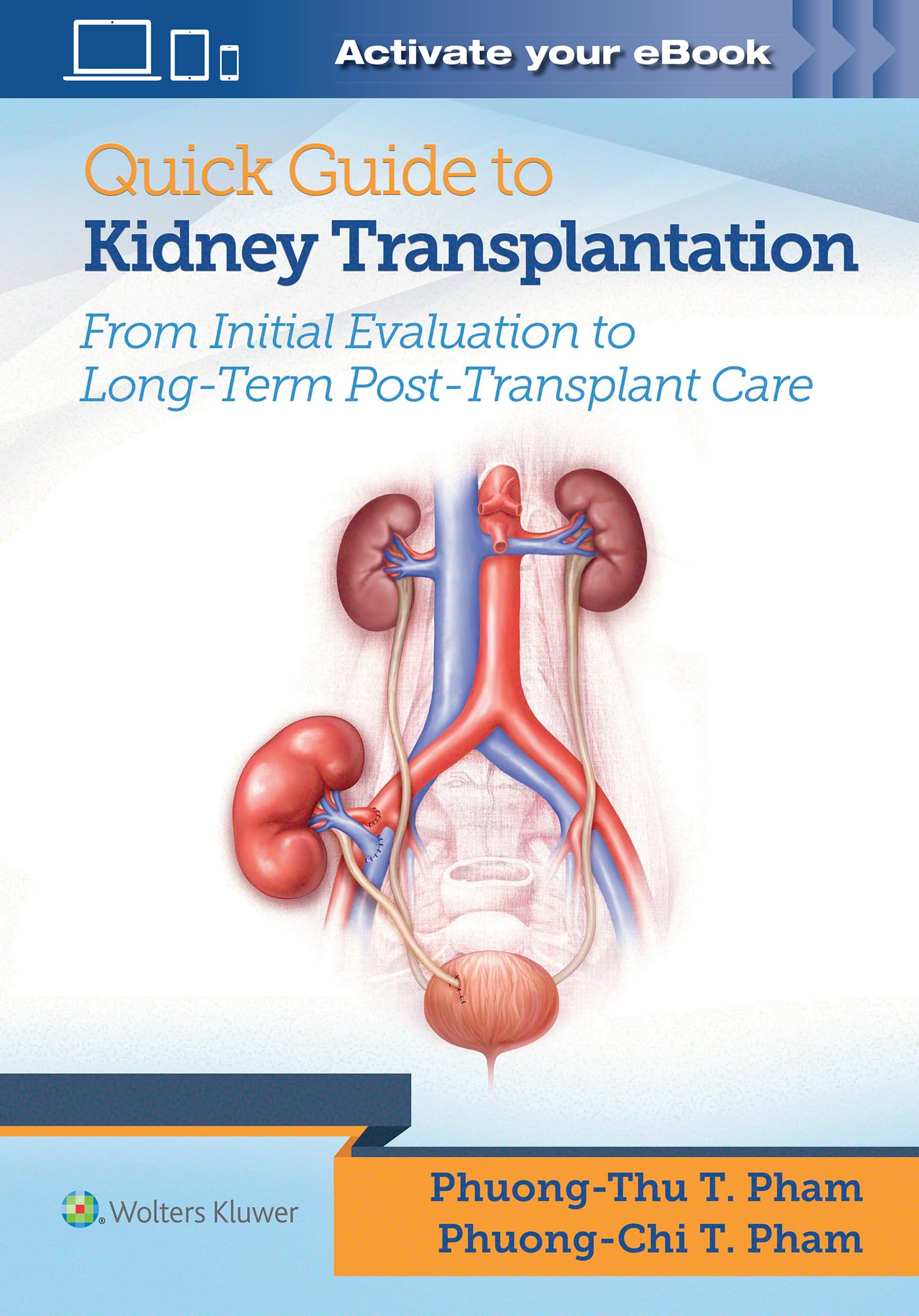 Cover of Quick Guide to Kidney Transplantation