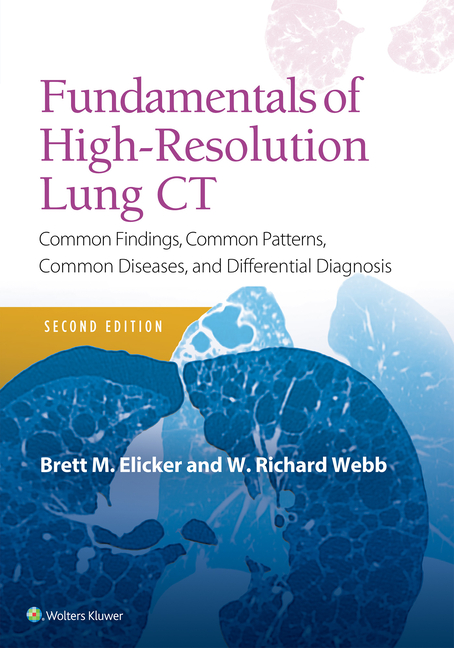 Cover of Fundamentals of High-Resolution Lung CT: Common Findings, Common Patterns, Common Diseases and Differential Diagnosis