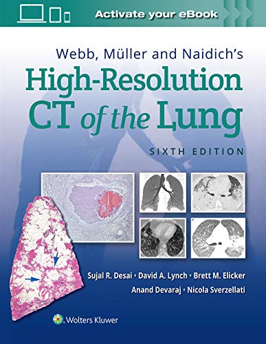 Cover of Webb, Müller and Naidich's High-Resolution CT of the Lung