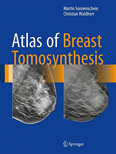 Cover of Atlas of Breast Tomosynthesis: Imaging Findings and Image-Guided Interventions