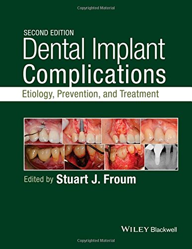 Cover of Dental Implant Complications: Etiology, Prevention, and Treatment