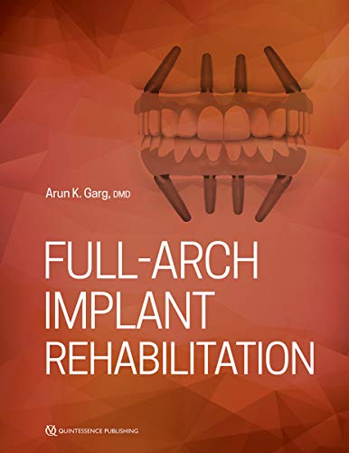 Cover of Full-Arch Implant Rehabilitation