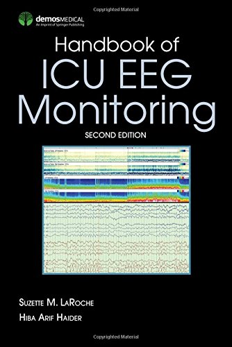 Cover of Handbook of ICU EEG Monitoring