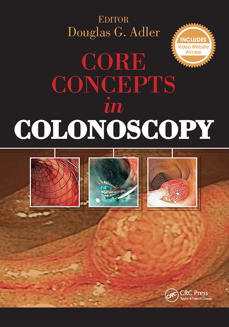 Cover of Core Concepts in Colonoscopy