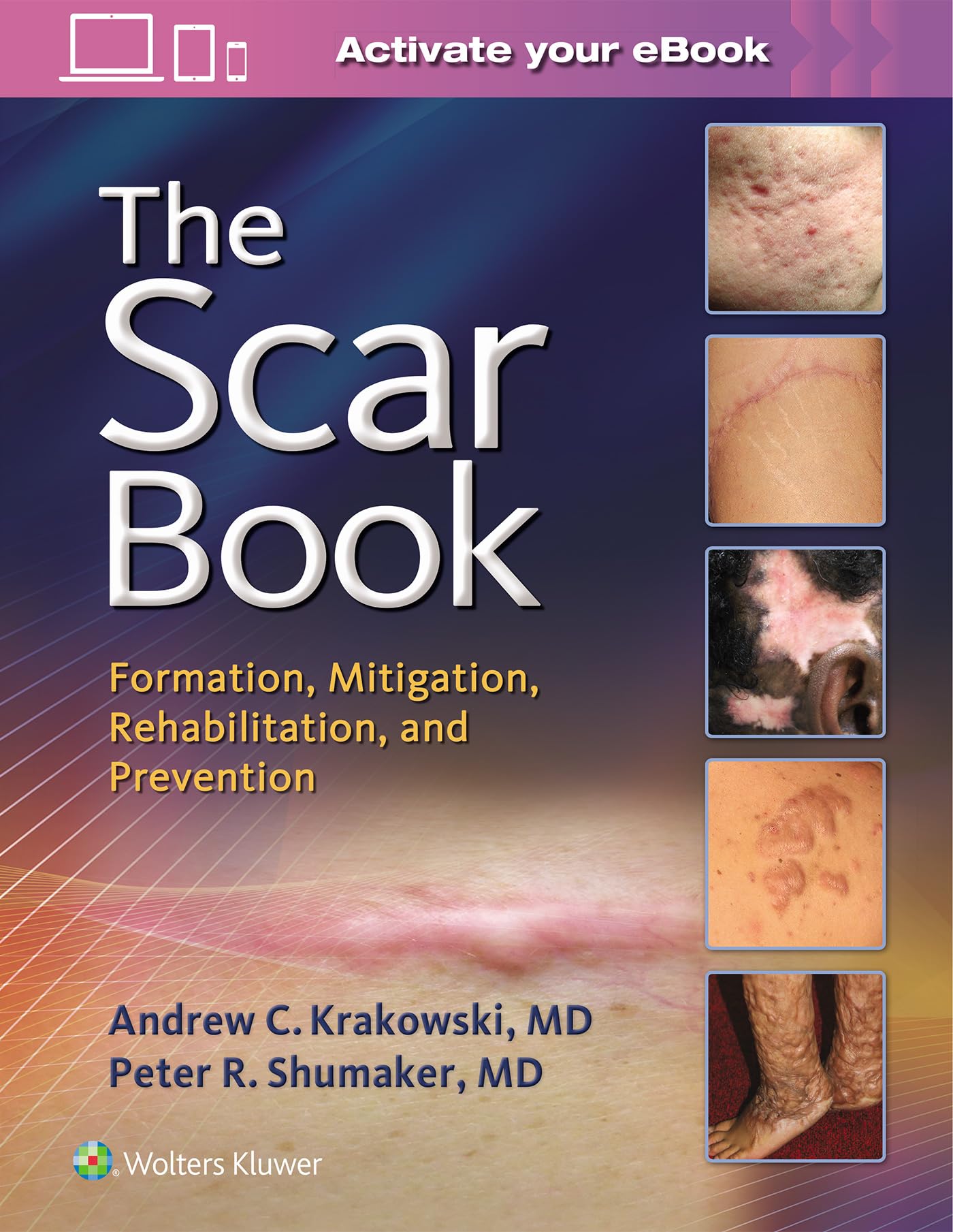 Cover of The Scar Book: Formation, Mitigation, Rehabilitation and Prevention