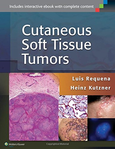 Cover of Cutaneous Soft Tissue Tumors