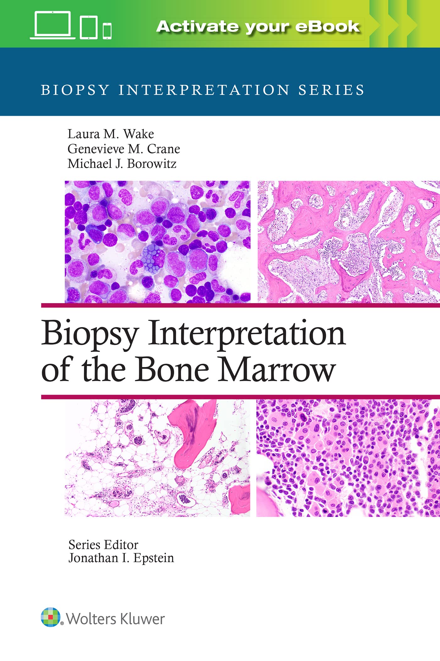 Cover of Biopsy Interpretation of the Bone Marrow: Print + eBook with Multimedia