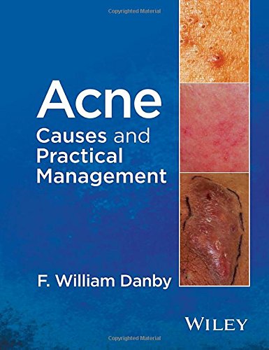 Cover of Acne: Causes and Practical Management