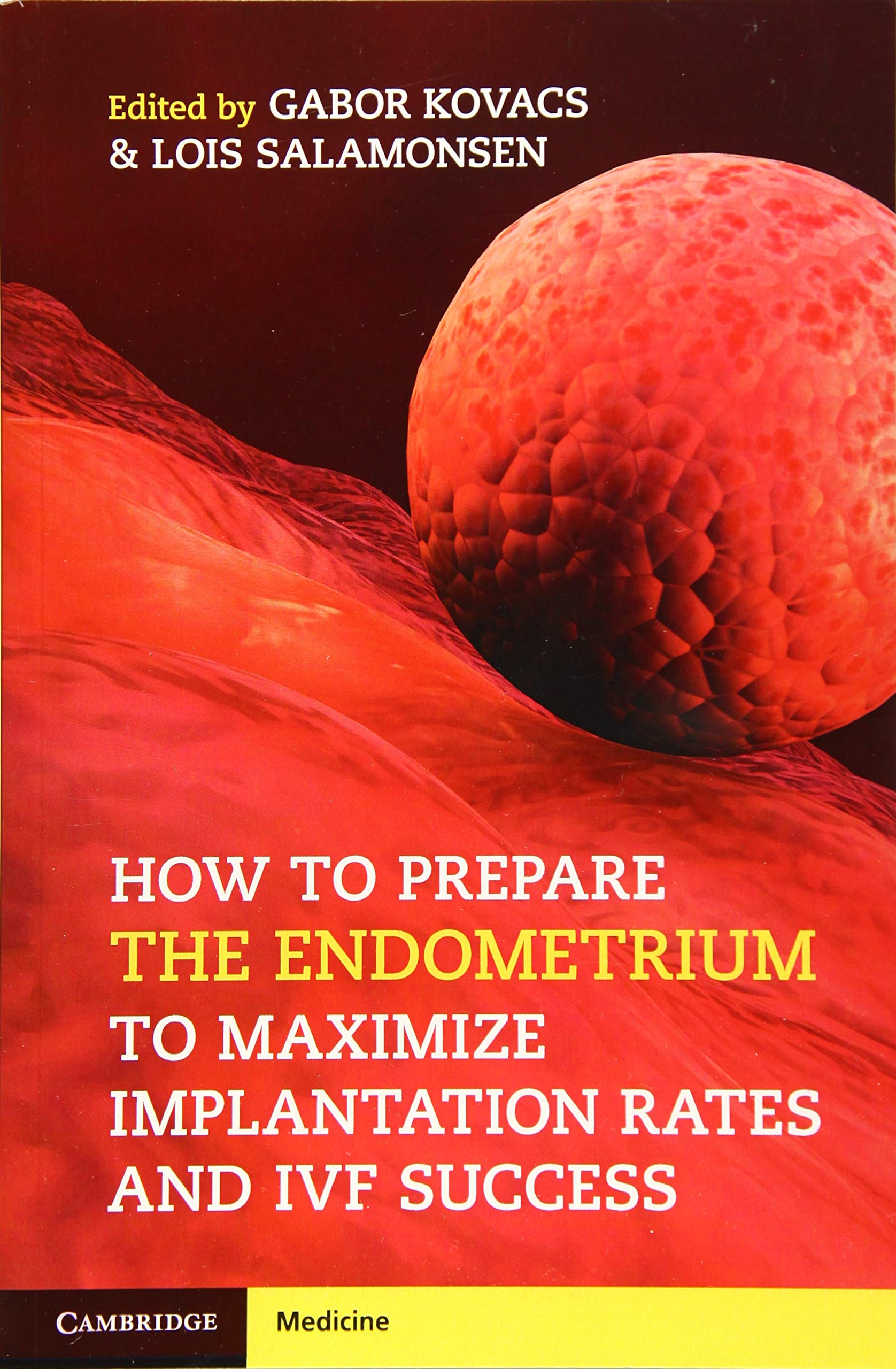 Cover of How to Prepare the Endometrium to Maximize Implantation Rates and IVF Success
