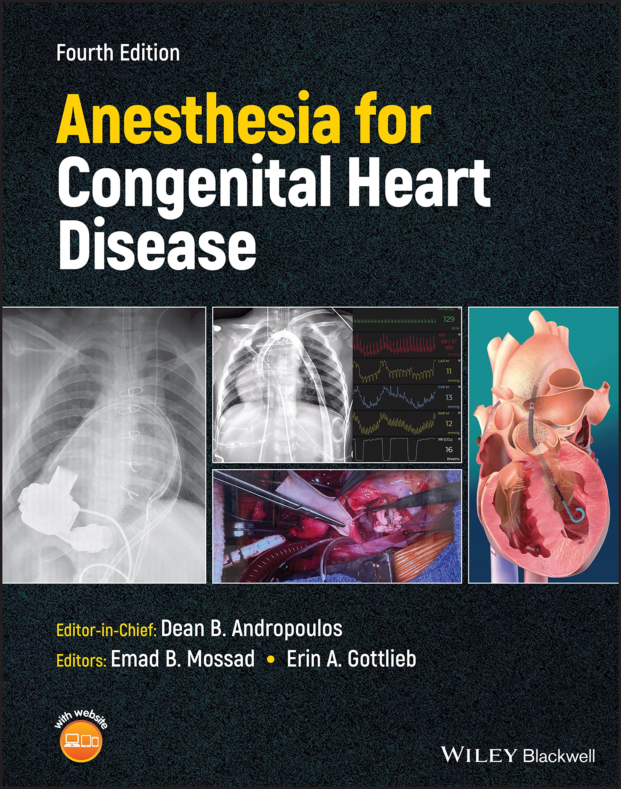 Cover of Anesthesia for Congenital Heart Disease