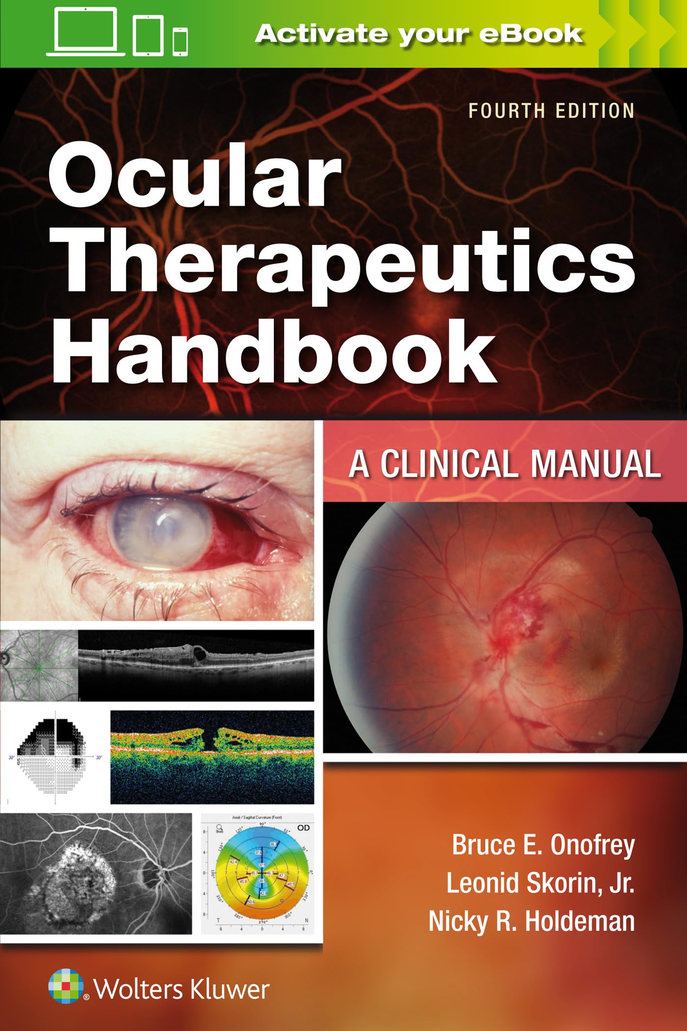 Cover of Ocular Therapeutics Handbook: A Clinical Manual