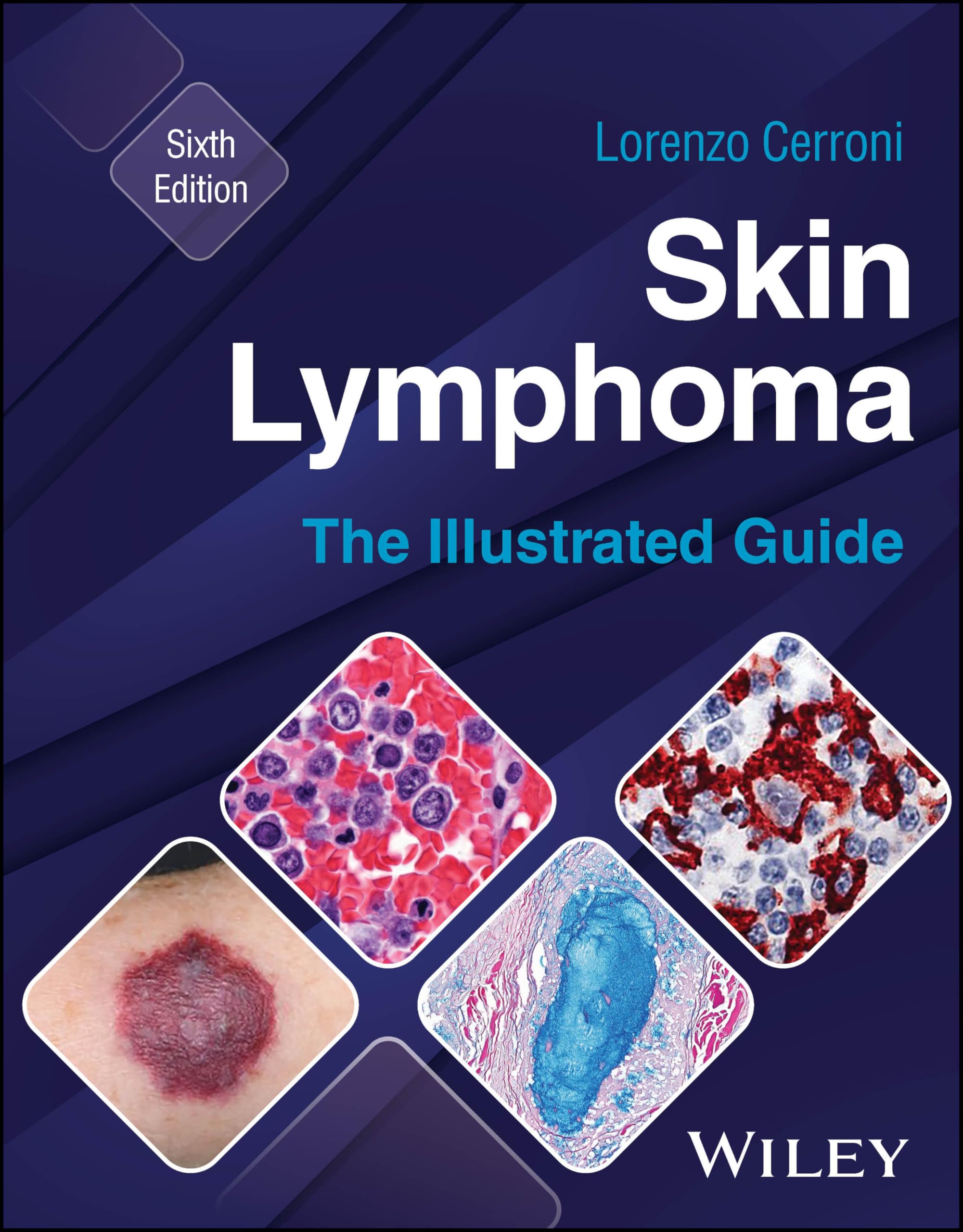Cover of Skin Lymphoma: The Illustrated Guide