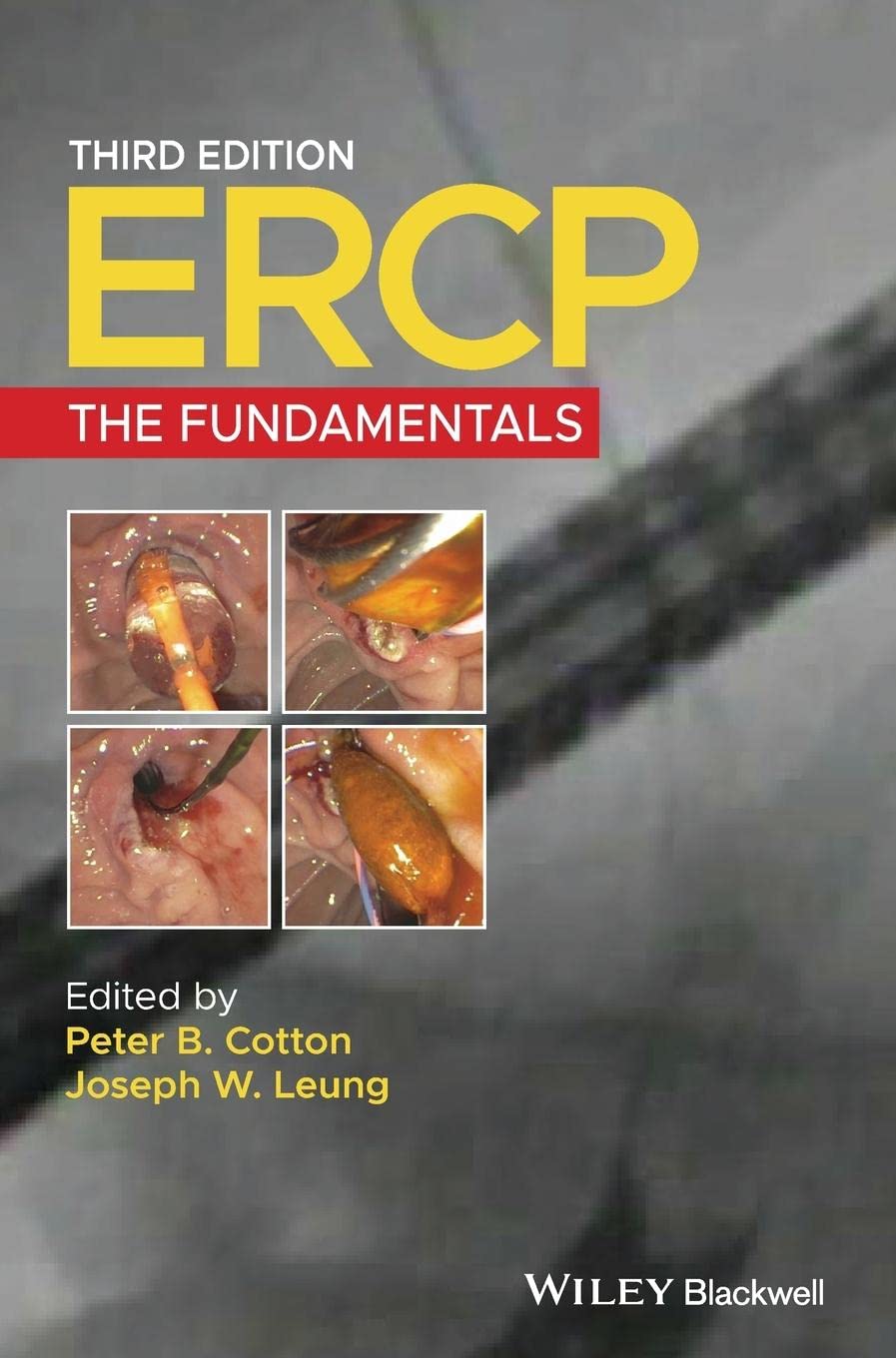 Cover of ERCP: The Fundamentals