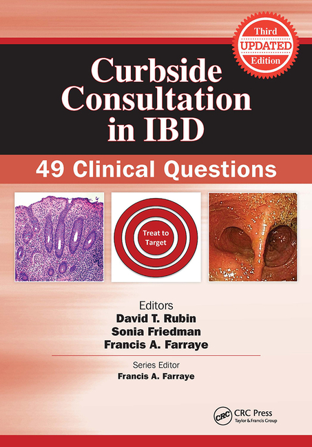 Cover of Curbside Consultation in IBD: 49 Clinical Questions