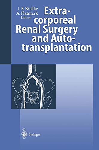Cover of Extracorporeal Renal Surgery and Autotransplantation