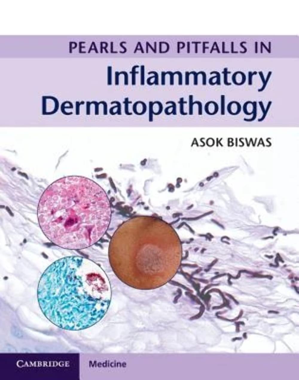 Cover of Pearls and Pitfalls in Inflammatory Dermatopathology