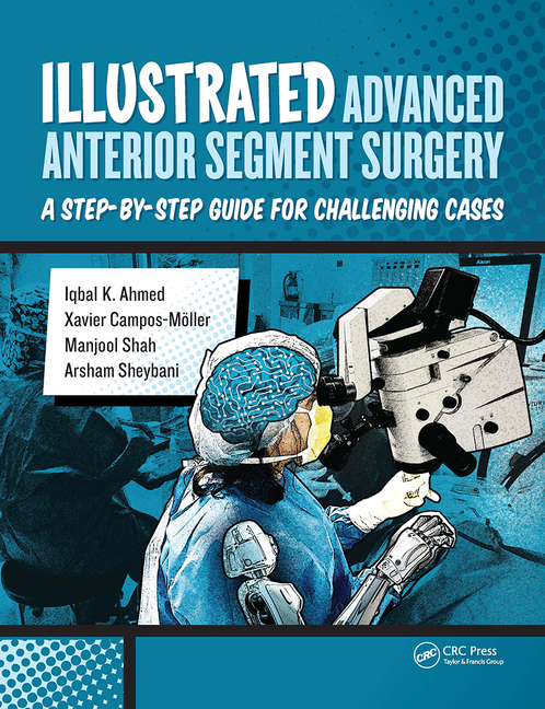 Cover of Illustrated Advanced Anterior Segment Surgery: A Step-by-Step Guide for Challenging Cases
