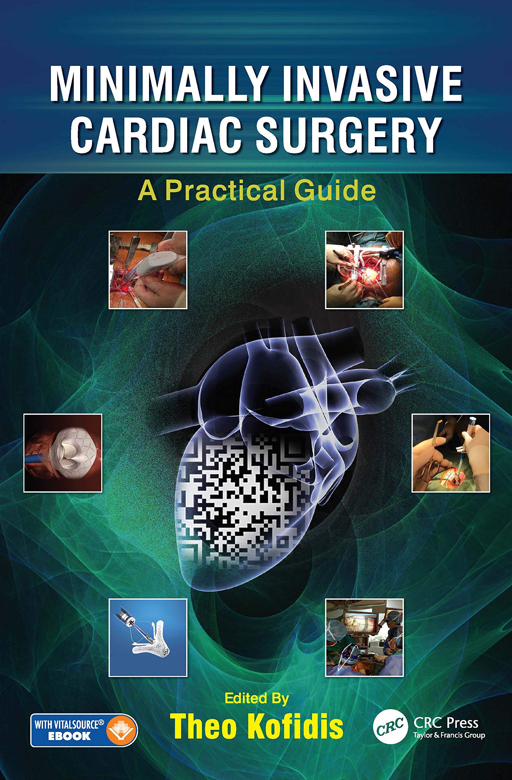 Cover of Minimally Invasive Cardiac Surgery: A Practical Guide