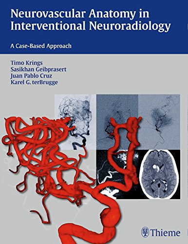 Cover of Neurovascular Anatomy in Interventional Neuroradiology: A Case-Based Approach