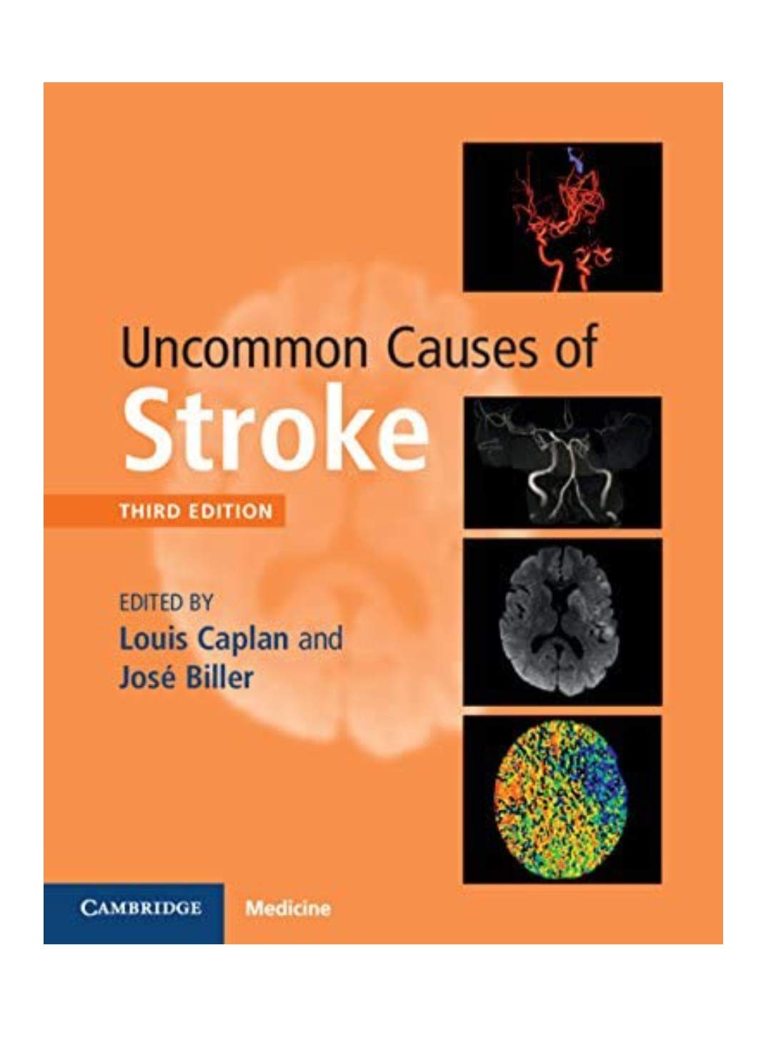 Cover of Uncommon Causes of Stroke (Revised)