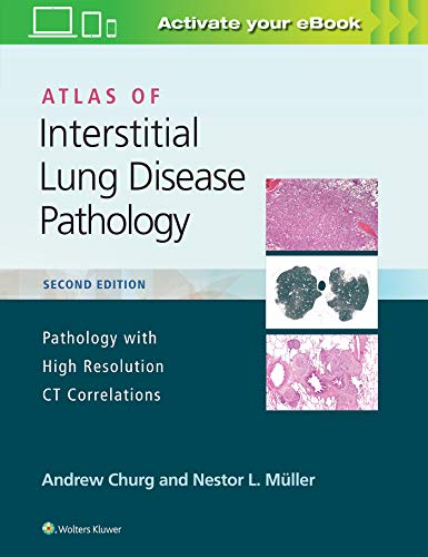 Cover of Atlas of Interstitial Lung Disease Pathology
