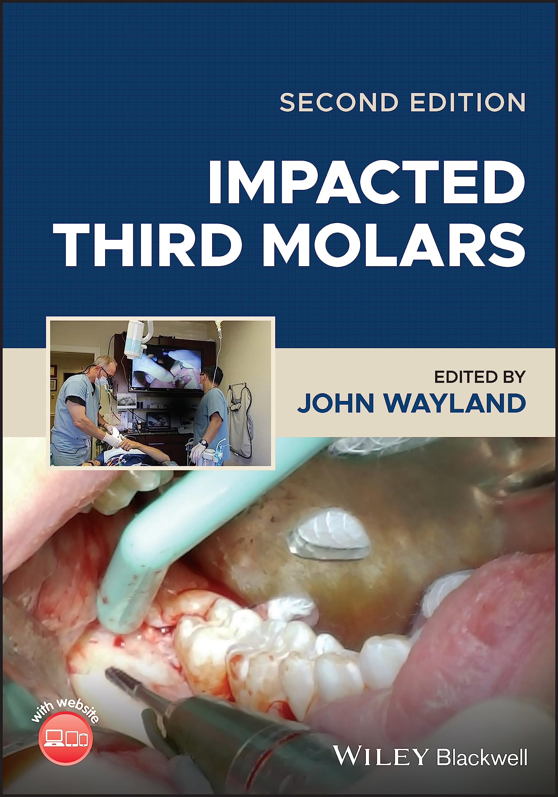 Cover of Impacted Third Molars