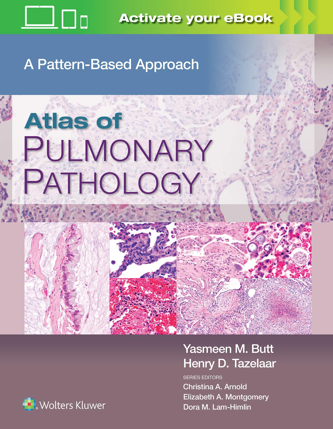 Cover of Atlas of Pulmonary Pathology: A Pattern Based Approach