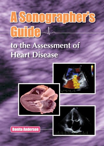 Cover of Sonographer's Guide to the Assessment of Heart Disease