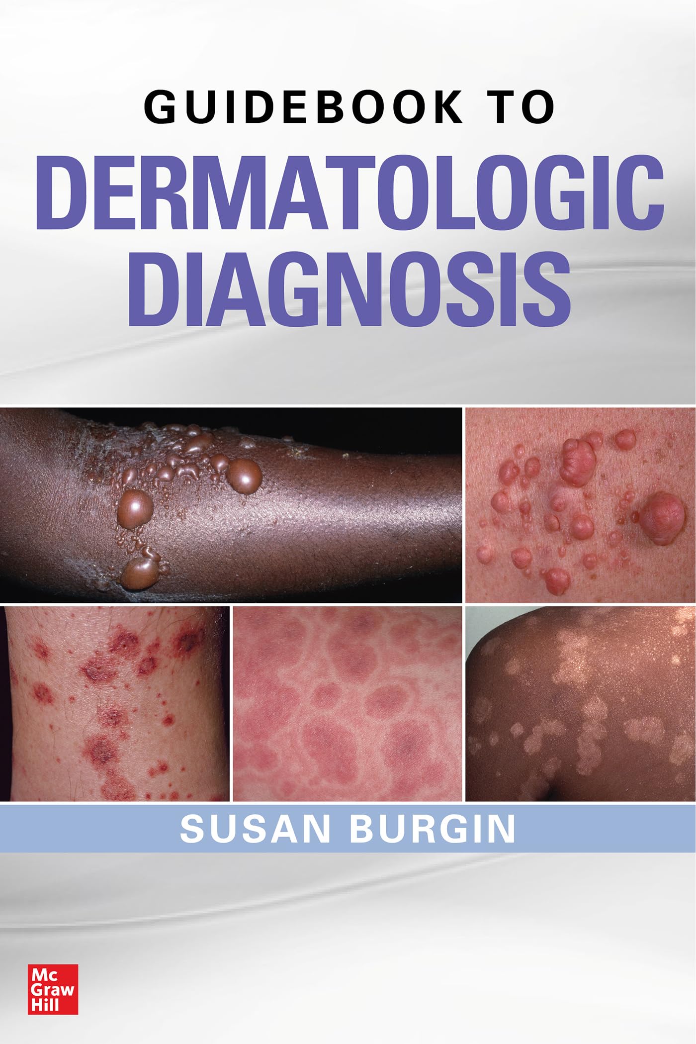 Cover of Guidebook to Dermatologic Diagnosis