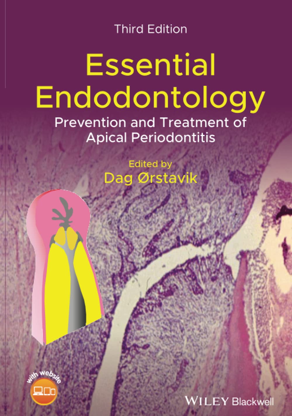 Cover of Essential Endodontology: Prevention and Treatment of Apical Periodontitis