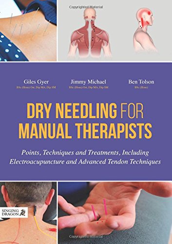 Cover of Dry Needling for Manual Therapists: Points, Techniques and Treatments, Including Electroacupuncture and Advanced Tendon Techniques