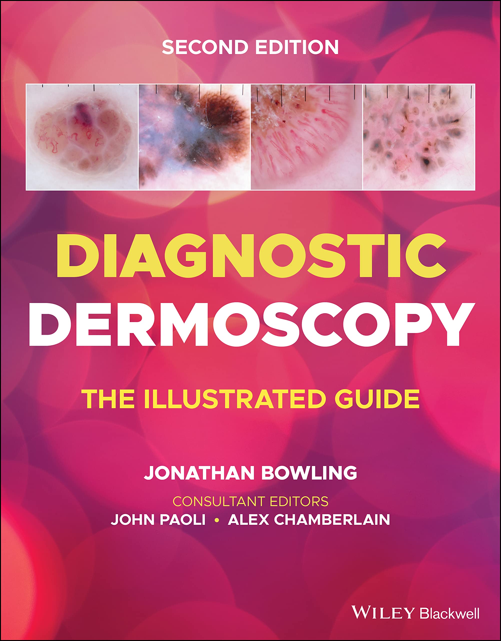 Cover of Diagnostic Dermoscopy: The Illustrated Guide