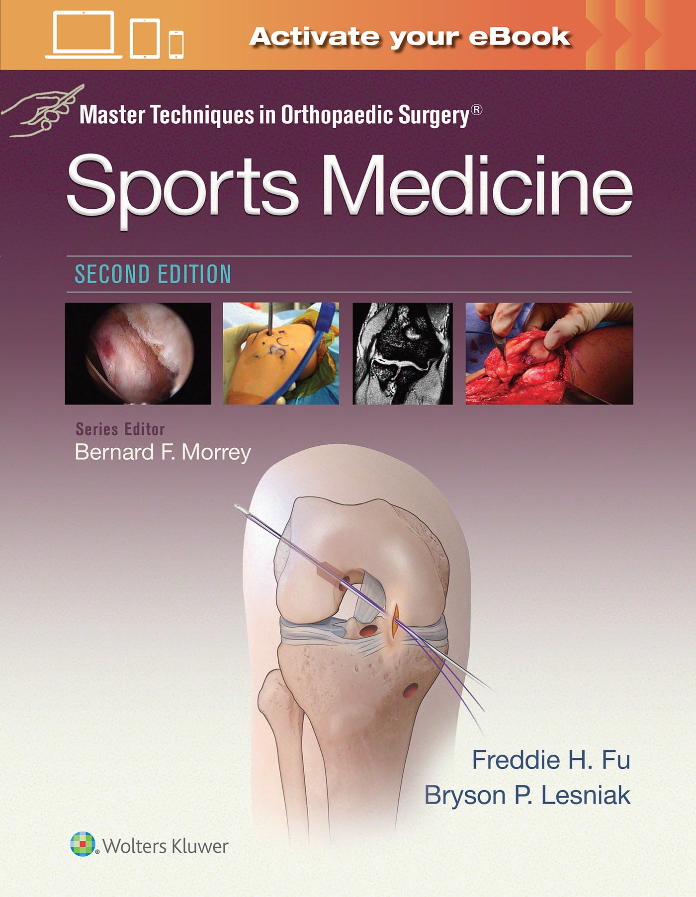 Cover of Master Techniques in Orthopaedic Surgery: Sports Medicine