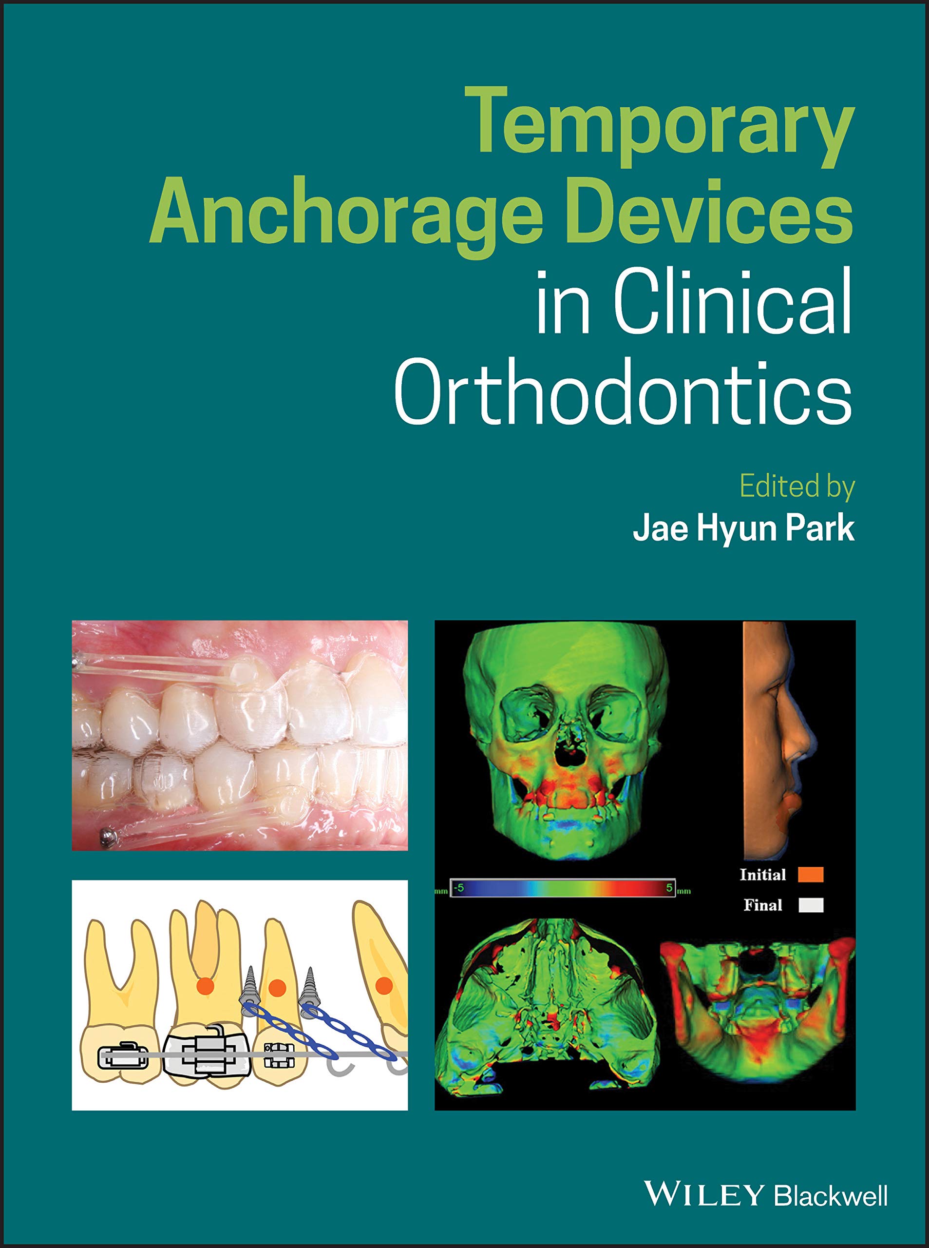 Cover of Temporary Anchorage Devices in Clinical Orthodontics
