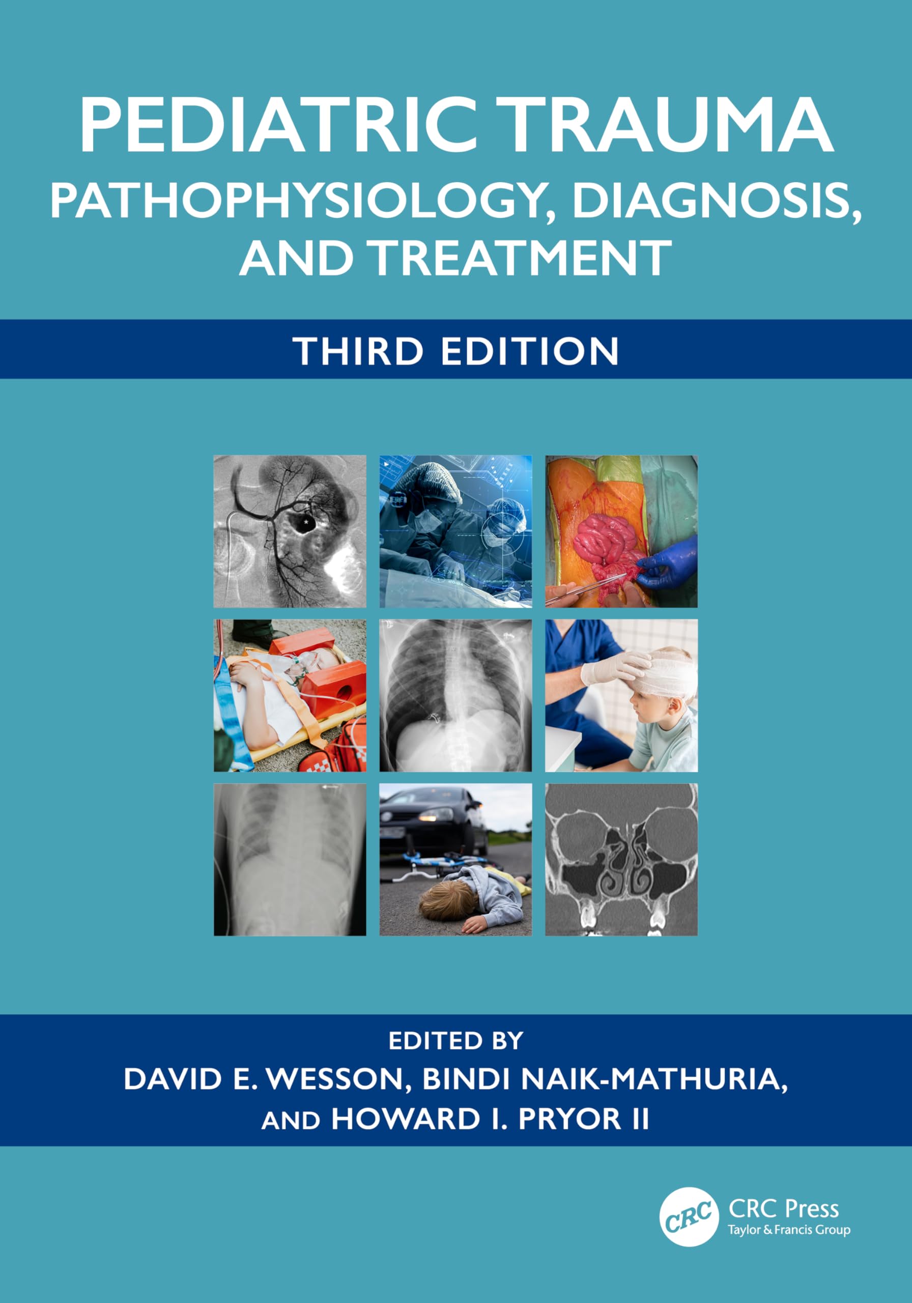 Cover of Pediatric Trauma: Pathophysiology, Diagnosis, and Treatment