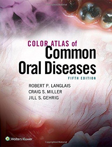 Cover of Color Atlas of Common Oral Diseases