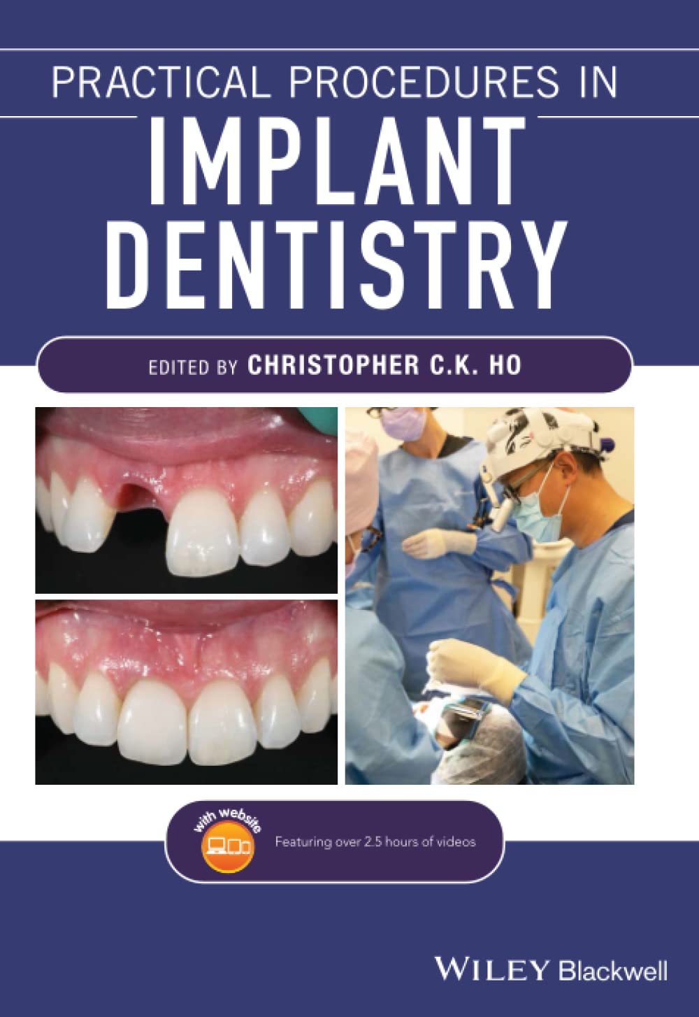 Cover of Practical Procedures in Implant Dentistry