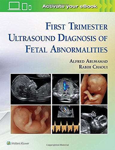 Cover of First Trimester Ultrasound Diagnosis of Fetal Abnormalities