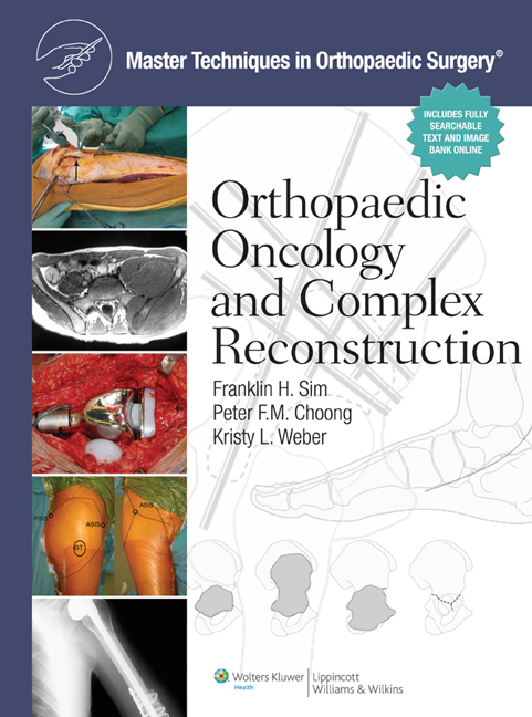 Cover of Master Techniques in Orthopaedic Surgery: Orthopaedic Oncology and Complex Reconstruction