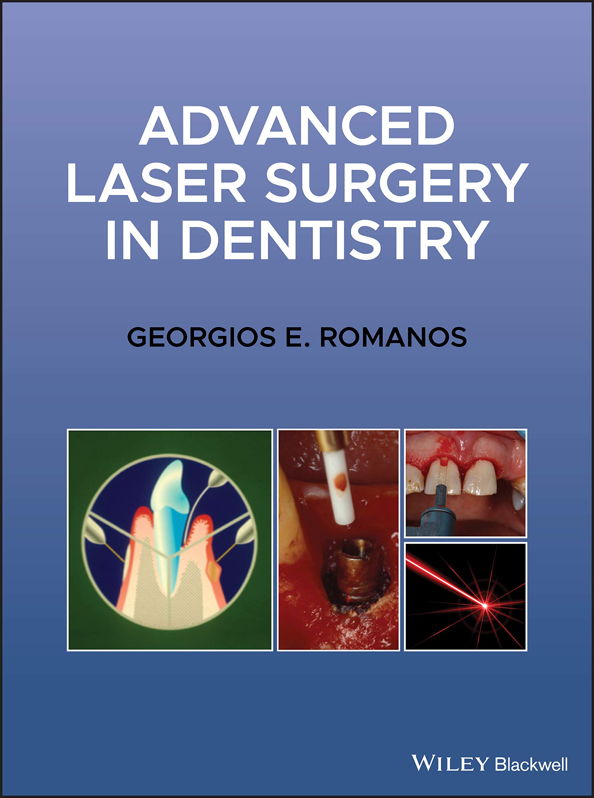 Cover of Advanced Laser Surgery in Dentistry