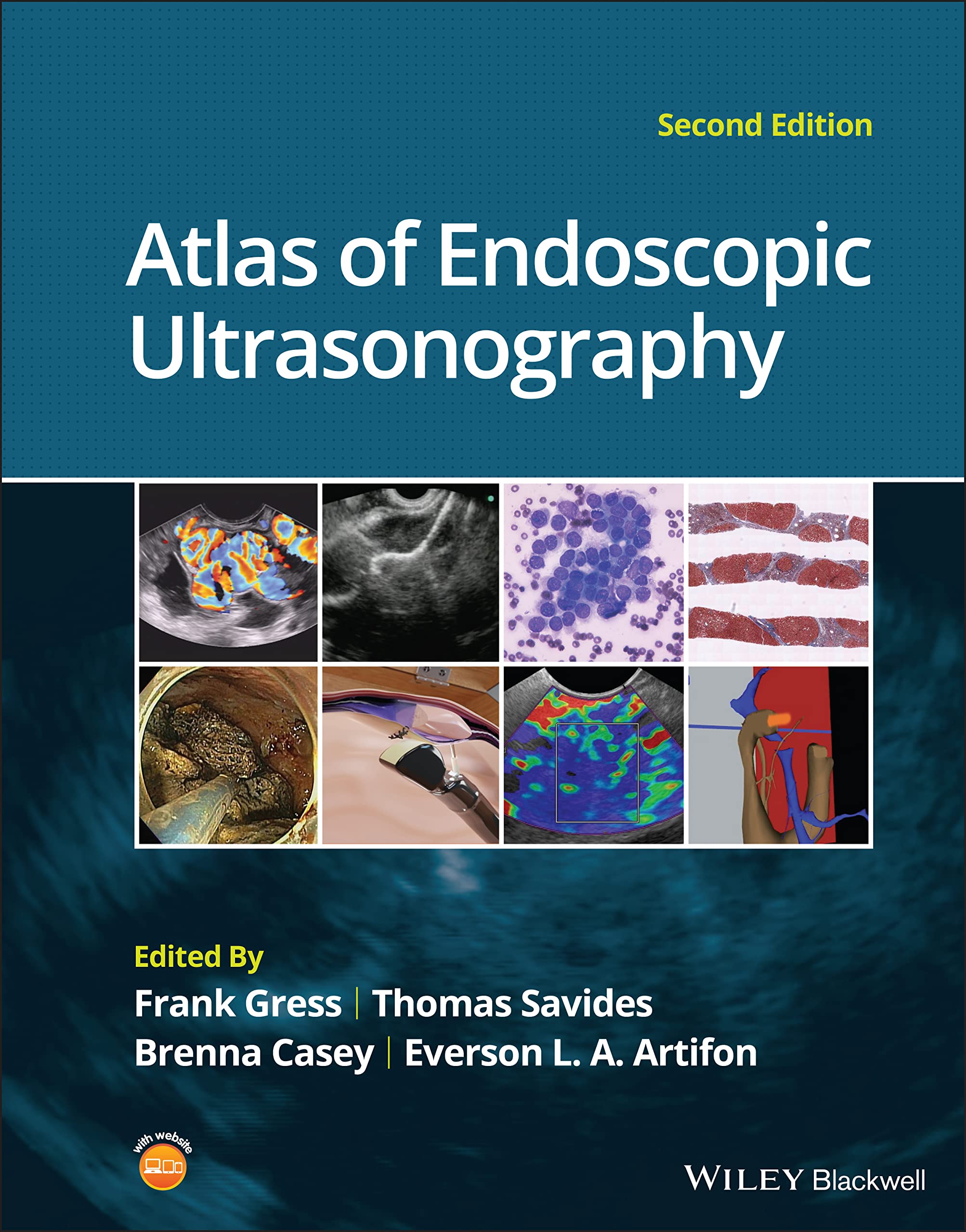 Cover of Atlas of Endoscopic Ultrasonography