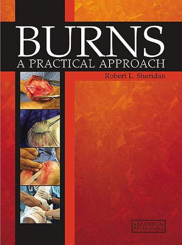 Cover of Burns: A Practical Approach to Immediate Treatment and Long-Term Care