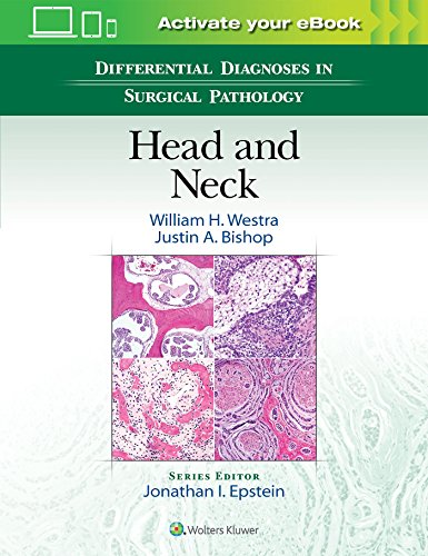 Cover of Differential Diagnoses in Surgical Pathology: Breast, None