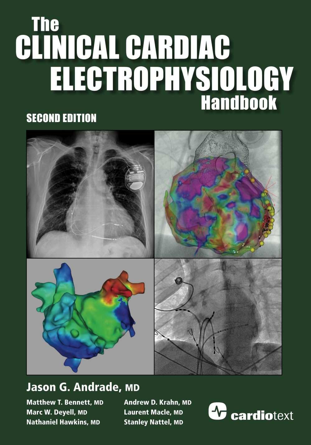 Cover of The Clinical Cardiac Electrophysiology Handbook, Second Edition