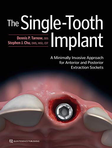 Cover of The Single-Tooth Implant (A Minimally Invasive Approach for Anterior and Posterior Extraction Sockets)